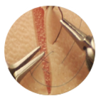 robotic-gynecologic-surgery-icon robotic-gynecologic-surgery-icon